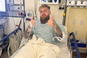 Jake Paul’s Broken Jaw Is a Brutal Reminder of the Price of Skipping