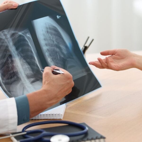 x ray